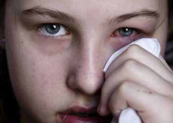 Ένα σύμπτωμα στα μάτια ίσως είναι το πρώτο σημάδι COVID-19