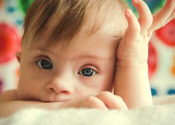 Παγκόσμια ημέρα για το σύνδρομo Down: Ημέρα ελπίδας!