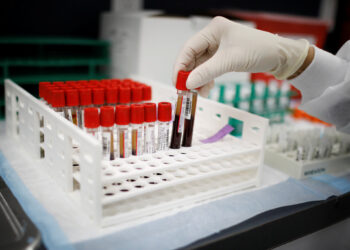 αιματολογικές εξετάσεις βιολογία