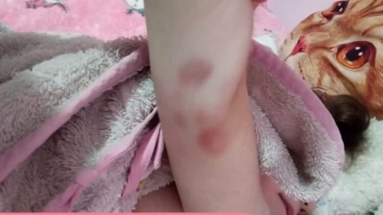 Θάνατος τριών παιδιών στην Πάτρα: Φωτογραφία – ντοκουμέντο με μελανιές στο χέρι της Τζωρτζίνας