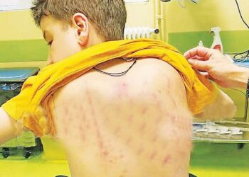 Σάπισαν στο ξύλο μαθητή ΑμεΑ – Η μήνυση και η δίωξη συμμαθητών