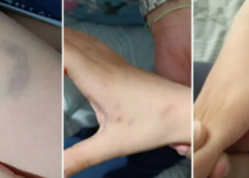 Να τον μυρίσει ήθελε… Διευθύντρια σχολείου στην Άρτα δάγκωσε 11χρονο μαθητή (φωτο)!