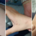 Να τον μυρίσει ήθελε… Διευθύντρια σχολείου στην Άρτα δάγκωσε 11χρονο μαθητή (φωτο)!