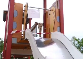 Άριστη η κατάσταση του δακτύλου της 8χρονης – Τι λέει o πλαστικός χειρουργός που τη χειρούργησε (video)