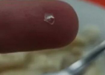 Πάτρα: Φοιτητής δείχνει το γυαλί που βρήκε στο φαγητό του – Η αντίδραση του Πρύτανη μετά την καταγγελία