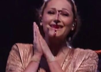 Γερμανία: Σοκαριστικό ατύχημα επί σκηνής – Τραγουδίστρια έσκισε το πρόσωπό της (video)