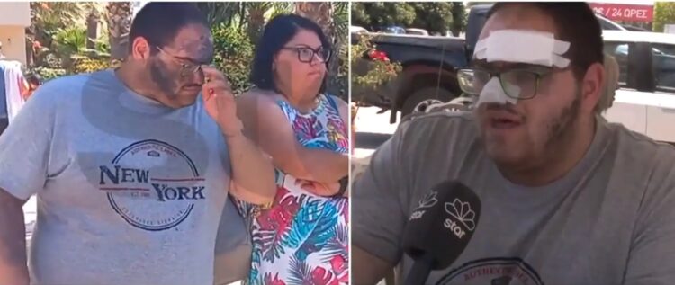 «Οι υπεύθυνοι με έβαλαν σε ψυγείο με κρέατα»! Συγκλονίζει ο μάγειρας που κάηκε με λάδι-Τον είχαν και Ανασφάλιστο[video]