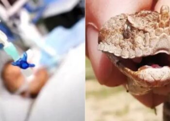 Δρaματική Εξέλιξη για το 4χρονο κοριτσάκι που το δάγκωσε Οχιά-Εσπευσμένα σε ΜΕΘ στη Θεσσαλονίκη