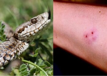 Γιατρός εξηγεί τα μεγάλα λάθη που κάνουν κάποιοι όταν τους δαγκώσει φίδι – Η έξαρση των επιθέσεων