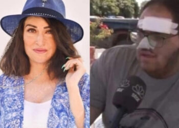 Η Ιωάννα Παλιοσπύρου θα αναλάβει όλα τα έξοδα του 22χρονου μάγειρα που κάηκε από λάδι στην Κρήτη