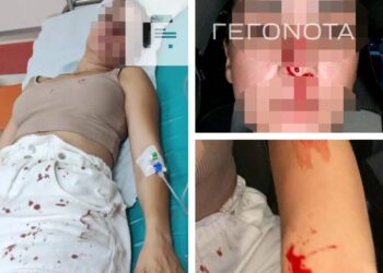 «Έπεσε, τι δεν καταλαβαίνετε»: Σοκάρουν τα τραύματα της 30χρονης – Δεν εμφανίστηκε ο διεθνής αθλητής (φωτο)