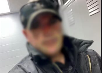 Παντρεμένος Αστυνομικός συνέλαβε την ερωμένη του και την απείλησε ότι «θα τη βγάλει τρελή» επειδή τον χώρισε[Φωτογραφίες]