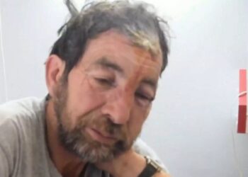 Αυτός είναι ο άτυχος που δέχθηκε επίθεση από αρκούδα στη Φθιώτιδα – «Ήρθε πάνω στο κεφάλι μου»