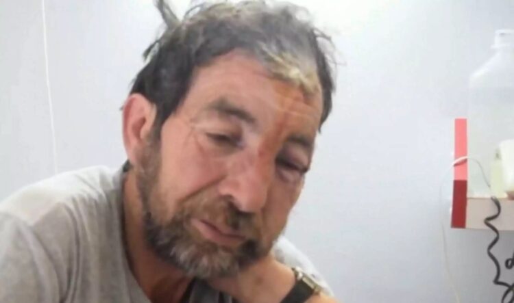 Αυτός είναι ο άτυχος που δέχθηκε επίθεση από αρκούδα στη Φθιώτιδα – «Ήρθε πάνω στο κεφάλι μου»