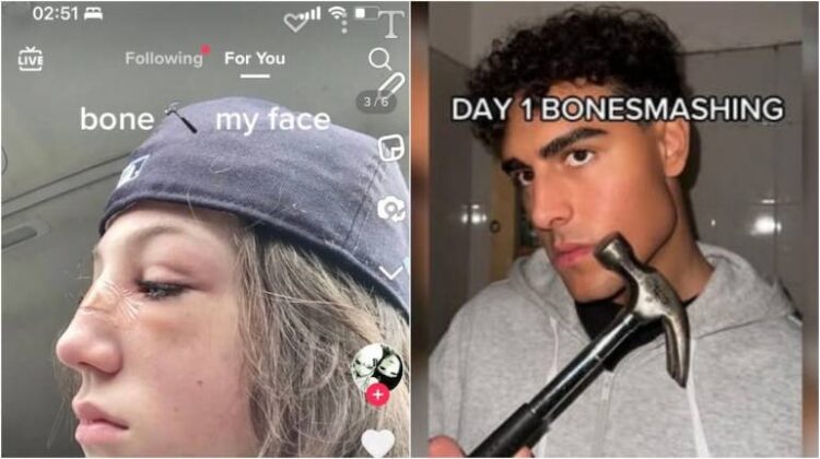 Άκρως επικίνδυνη η νέα τάση στο TikTok: “Έφηβοι σπάνε τα κόκκαλα του προσώπου τους”