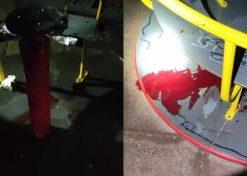 Σοκαριστικό ατύχημα σε παιδική χαρά: Ξεριζώθηκαν μαλλιά και δέρμα από το κεφάλι 14χρονης