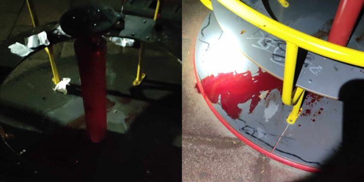 Σοκαριστικό ατύχημα σε παιδική χαρά: Ξεριζώθηκαν μαλλιά και δέρμα από το κεφάλι 14χρονης