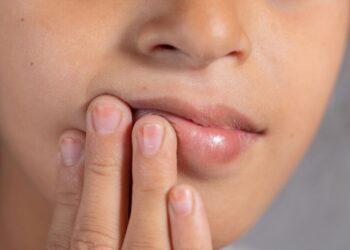 Καρδιακή προσβολή: Αυξημένος κίνδυνος αν συμβαίνει αυτό στο στόμα σας