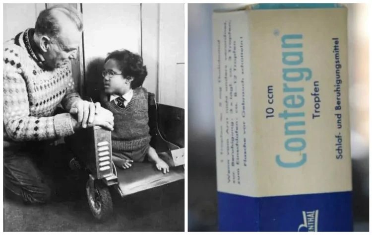 Το μεγαλύτερο ιατρικό λάθος της ιστορίας – Φάρμακο οδήγησε σε χιλιάδες τερατογενέσεις