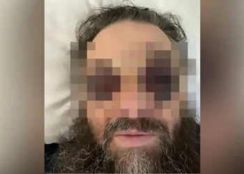 Μnτροπολίτης έπεσε θύμα άγρıου ξuλοδαρμού