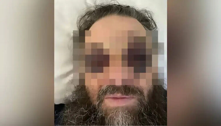 Μnτροπολίτης έπεσε θύμα άγρıου ξuλοδαρμού