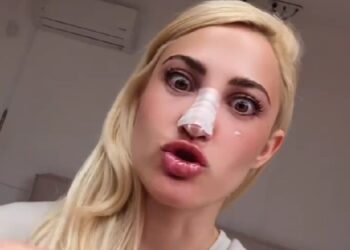 Ιωάννα Τούνη: «Αυτό που βλέπεις δεν είναι το τελικό αποτέλεσμα» – Η κατάστασή της μετά την επέμβαση στη μύτη