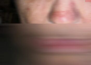 Εφιάλτης για 53χρονη γυναίκα με νοητική στέρηση στην Κρήτη: «Με πατούσαν στο πρόσωπο και την κοιλιά»