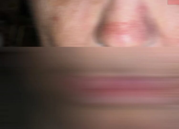 Εφιάλτης για 53χρονη γυναίκα με νοητική στέρηση στην Κρήτη: «Με πατούσαν στο πρόσωπο και την κοιλιά»