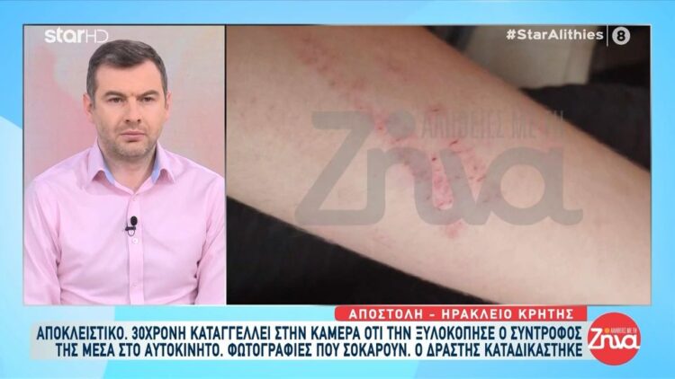 30χρονη έπεσε θύμα ξυλοδαρμού από τον σύντροφό της: Με είχε ξαναχτυπήσει και δεν είχα καλέσει την Αστυνομία…Όταν μπαίνει μπροστά ο φόβος δεν σκέφτεσαι λογικά…