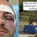Άγρια επίθεση στην Πάρνηθα: Νεαροί μαχαίρωσαν εθελοντές που καθάριζαν την περιοχή – «Εμείς είμαστε από το Μενίδι» φώναζαν