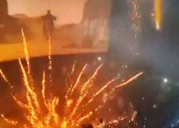 Παραλίγο τραγωδία: Μαθητής με σοβαρά εγκαύματα από βεγγαλικά σε σχολική γιορτή (φωτο)