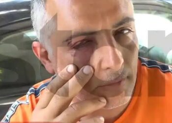 Άγριος ξυλοδαρμός ελεγκτή εισιτηρίων σε λεωφορείο – «Με δάγκωσαν, με χτυπούσαν στο κεφάλι»